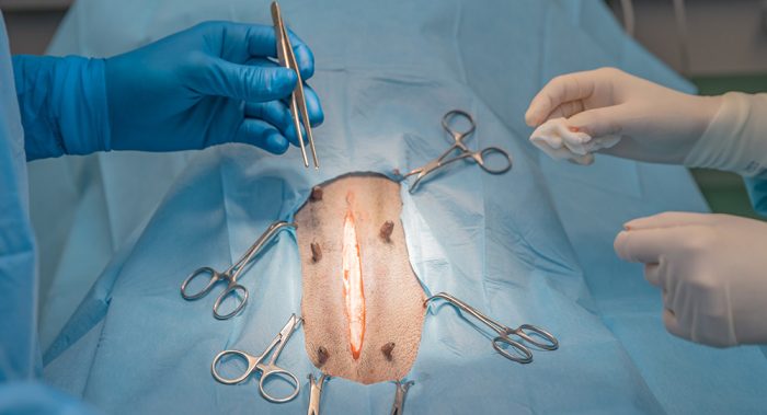 Practical Abdominal Surgery